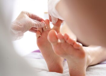 Foot Fungus Doctor Near Me: The Top Signs You Need Treatment