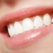 Transforming Your Smile without Breaking the Bank: Budget-Friendly Options