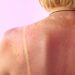 Sun Spots vs Skin Cancer: What’s the Difference?
