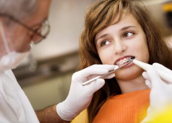 Breaking Down the Misconceptions of Braces on Crooked Teeth