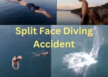 split face diving accident