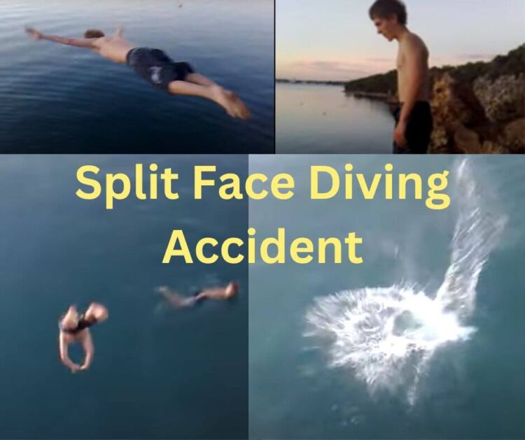 split face diving accident