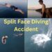 split face diving accident