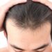 damaged men's hair