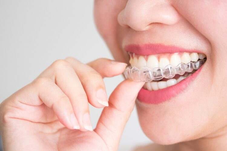 invisalign express cost
