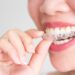 invisalign express cost