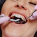 The Ultimate Guide to the Most Popular Cosmetic Dental Procedures