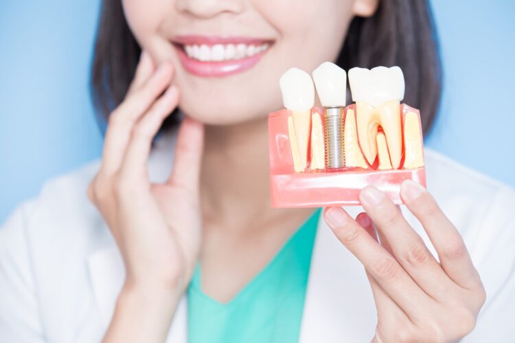 How to Care for Dental Implants: 3 Helpful Tips