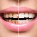 The Ultimate Guide to Understanding Cosmetic Dentistry Costs