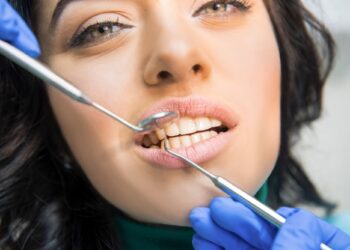 The Importance of Taking Action When a Tooth is Loose But Still Attached