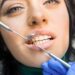 The Importance of Taking Action When a Tooth is Loose But Still Attached