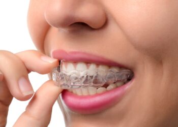 Debunking Myths About Invisalign for Adults: Separating Fact from Fiction