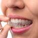 Debunking Myths About Invisalign for Adults: Separating Fact from Fiction