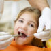 4 Must-Have Dental Hygiene Instruments for Every Professional