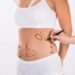 What to Expect and How to Plan Ahead in Preparing for Partial Hip Replacement Surgery