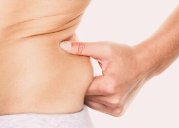 The Benefits of Back Fat Surgery