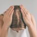 A Step-by-Step Guide to Scalp Micropigmentation for Women