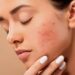 The Ultimate Guide to Aesthetics Solutions for Reducing Wrinkles