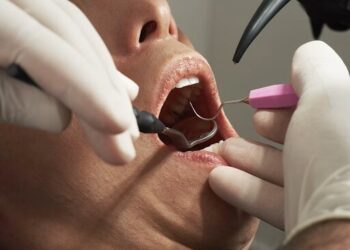 What Actually Happens During a Full Mouth Restoration